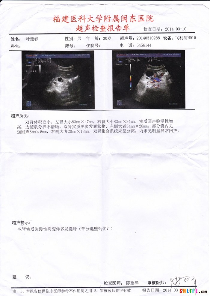 超声检验报告